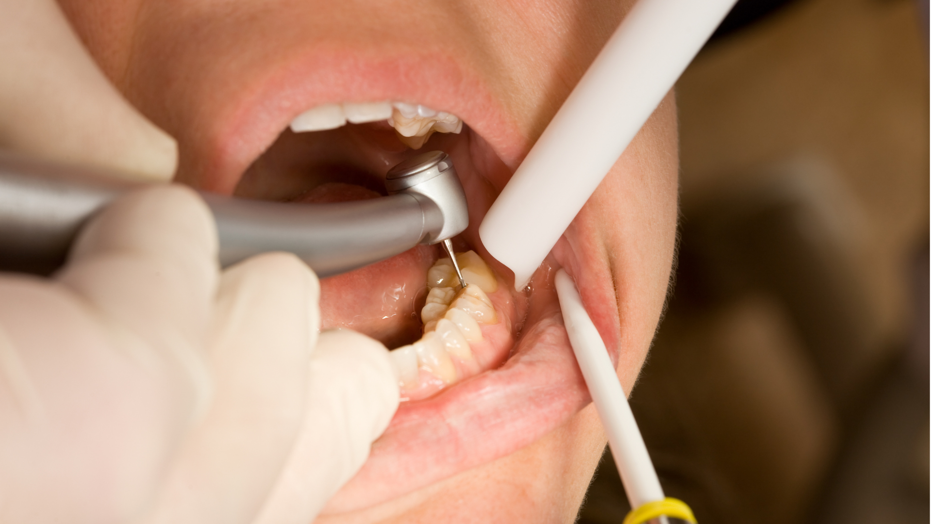 Restorative Treatments