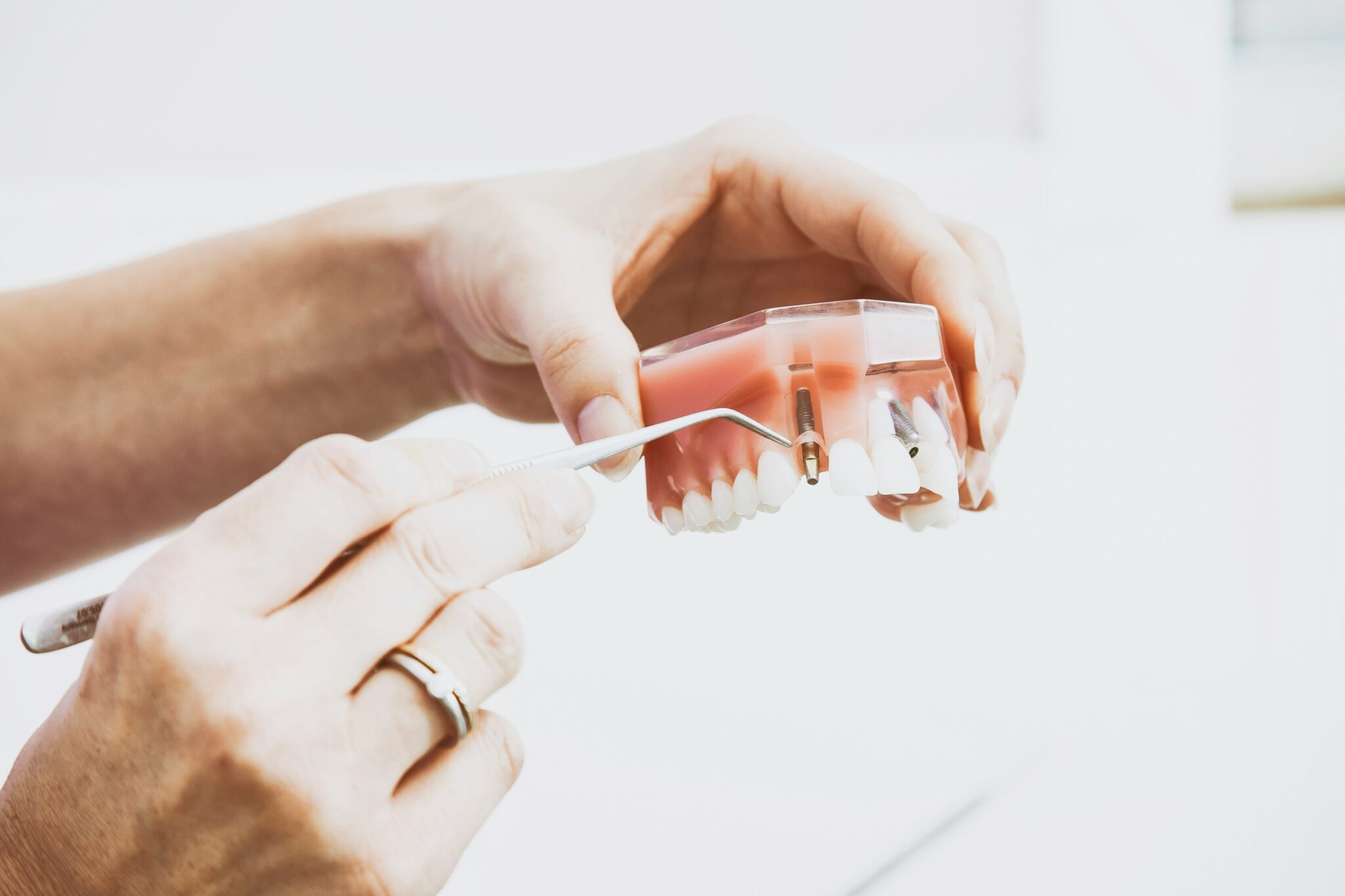 Implant Treatments